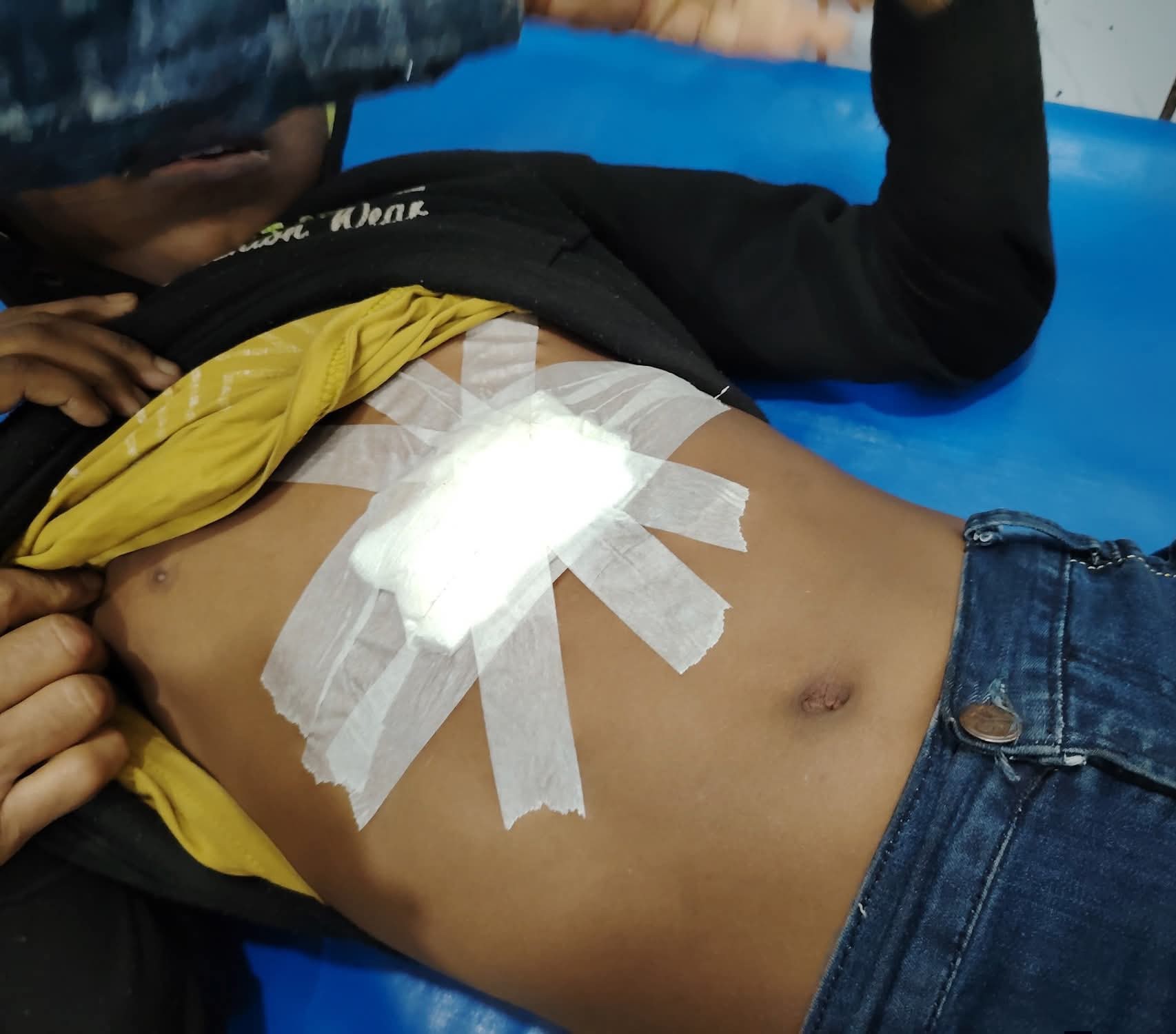 রাজবাড়ীতে থার্টি ফার্স্ট নাইটে দুই পক্ষের সংঘর্ষের ছোড়া গুলিতে গুলিবিদ্ধ হলো শিশু সিফাত